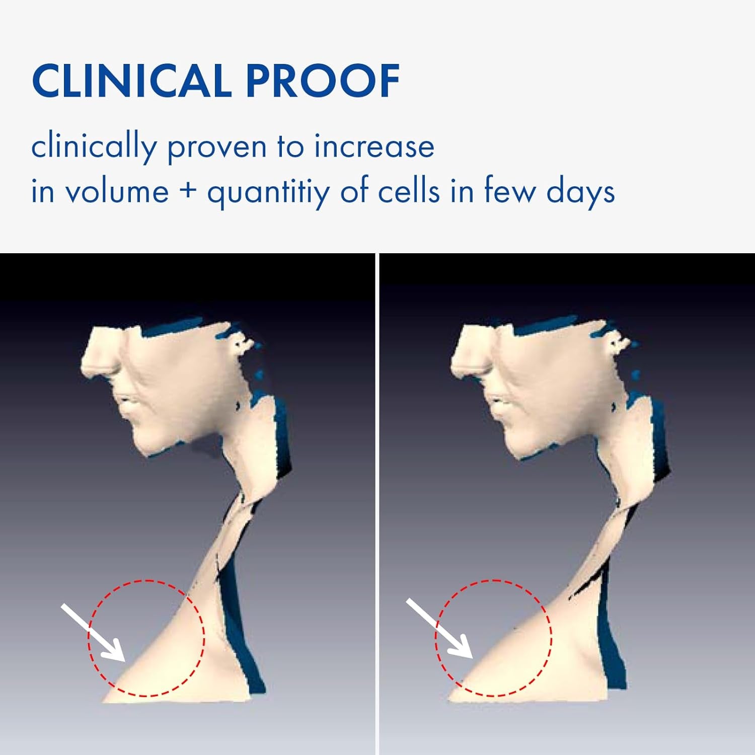 Volufiline Serum, 100% France Sederma Volufiline Concentrate for Plumping, Skin Firming, Boost and Glass Skin, Glow Skincare for Face, Lip and Body, 11Ml 0.37 Fl. Oz.