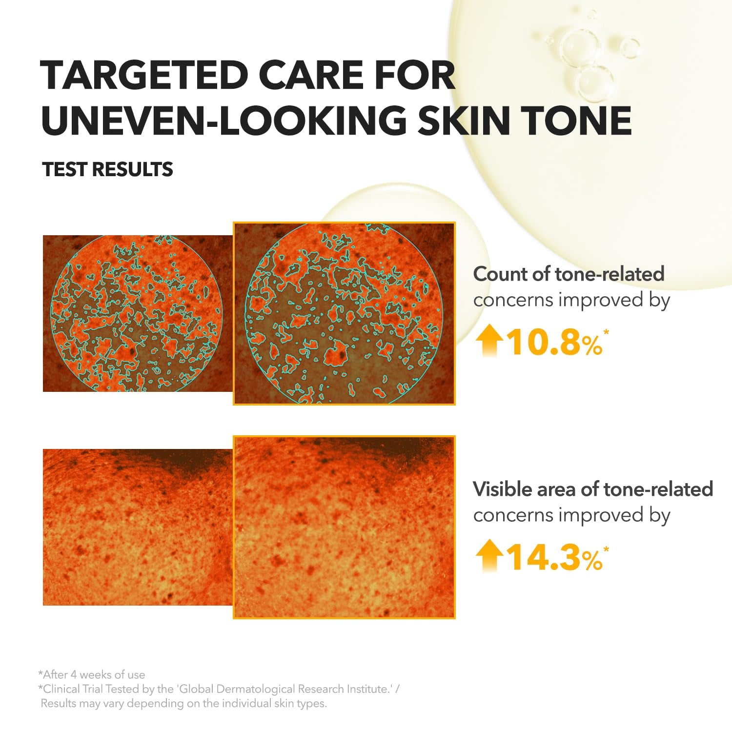 A.C.E Serum｜Vita Kojic Serum for Brightening & Glow｜3-Second Brightening｜Kojic Acid & Vitamin C for Uneven Skin Tone｜Korean Skin Care｜3.88 Oz.