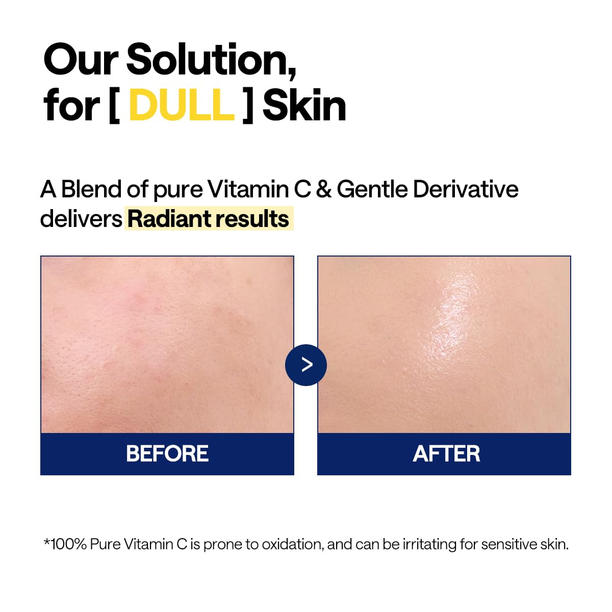 MEDIHEAL Vitamin C Brightening Serum With Niacinamide 30150 - 40ml