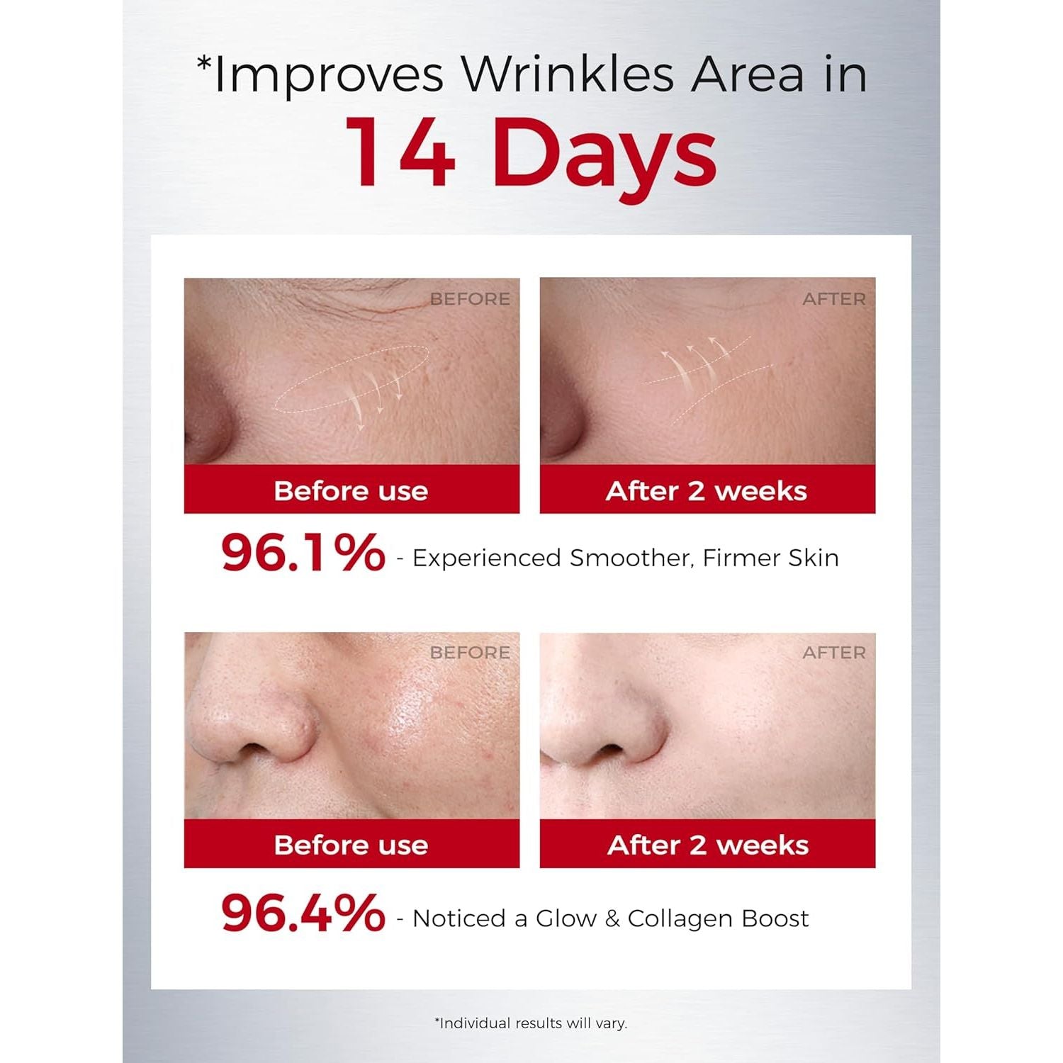 NING DERMOLOGIE Retinol Firming Smoothing Essence – 30ml | Gentle Retinol & Peptide Night Repair Serum