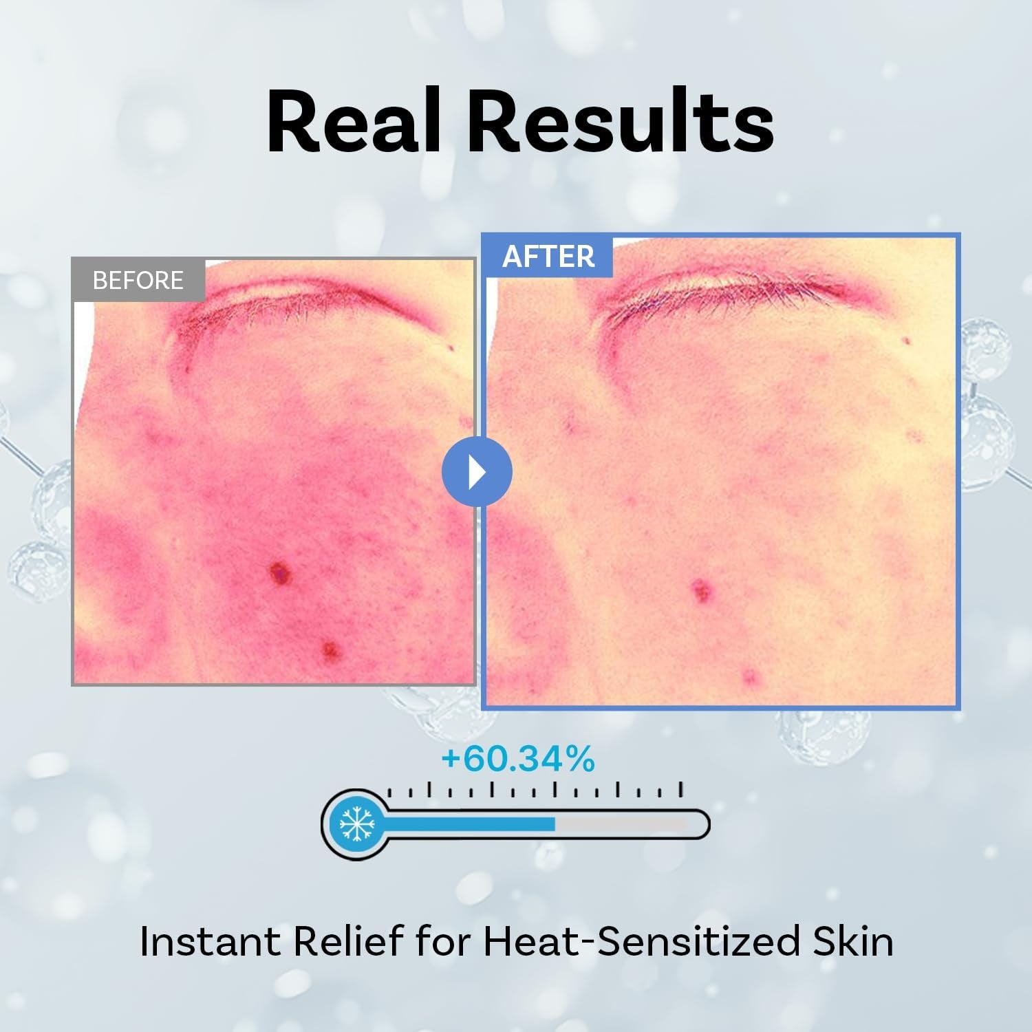 Exosome Squal-Tox 3% Ampoule 1.01 Fl Oz (30Ml) – Intense Hydration, Skin Renewal, Brightening & Anti-Wrinkle Care with Exosome Technology and Niacinamide