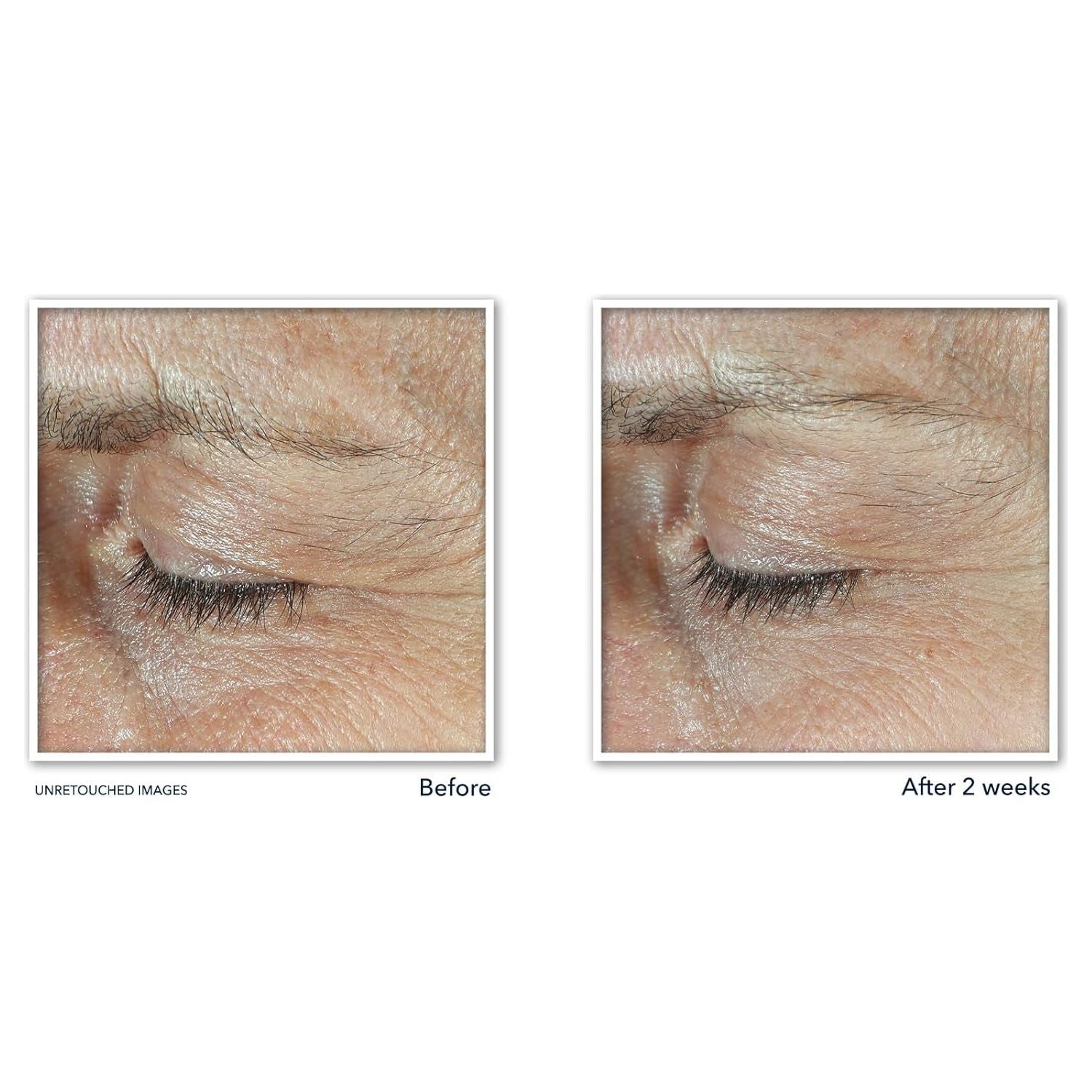 RoC + Derm Correxion Dual Eye Cream + Advanced Retinol + Peptides – 2 x 10ml | 2-in-1 Eye Lift System for Upper Lids & Under Eyes