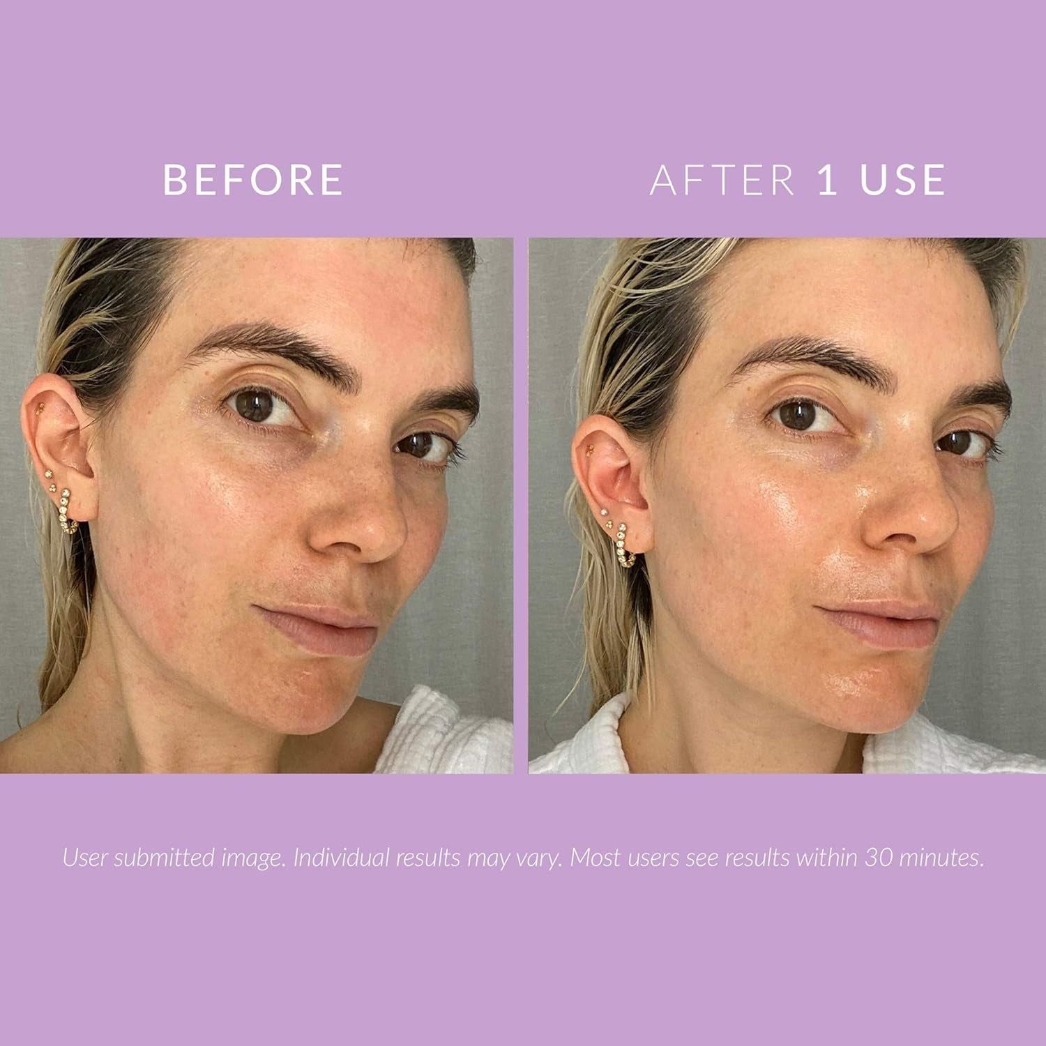 Kate Somerville DeliKate Recovery Cream - 1.7 fl oz (50ml)
