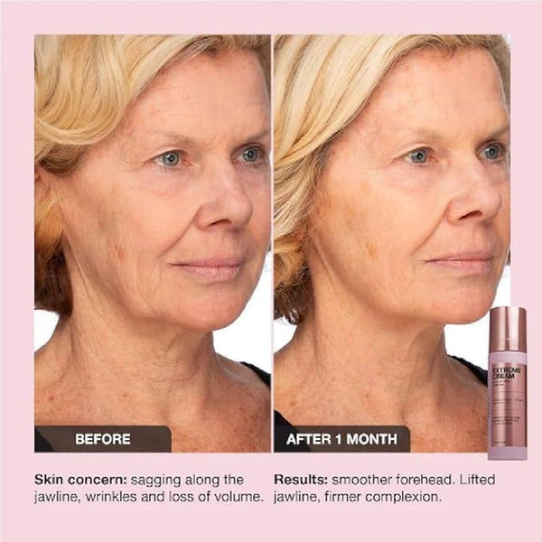 iNNBEAUTY PROJECT Extreme Cream Firming & Lifting Moisturizer – 50ml | Advanced Anti-Aging, Refillable Glow