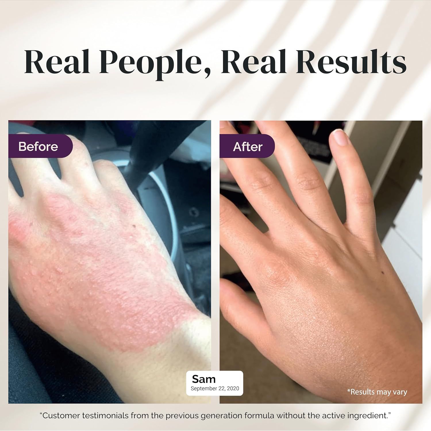 Puriya Eczema Cream - 113g