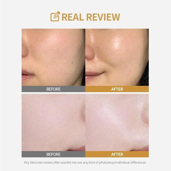 Hydrating Water Replenishing Facial Sheet Masks – Pack of 5