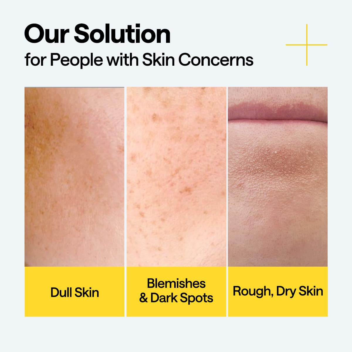 MEDIHEAL Vitamin C Brightening Serum With Niacinamide 30150 - 40ml