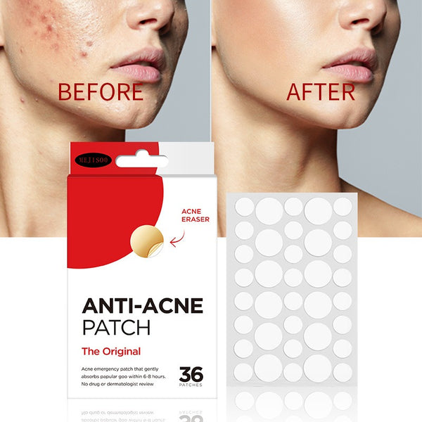 Acne Patch (36 Patches) – Water Gel Transparent Invisible Hydrocolloid Pimple Stickers