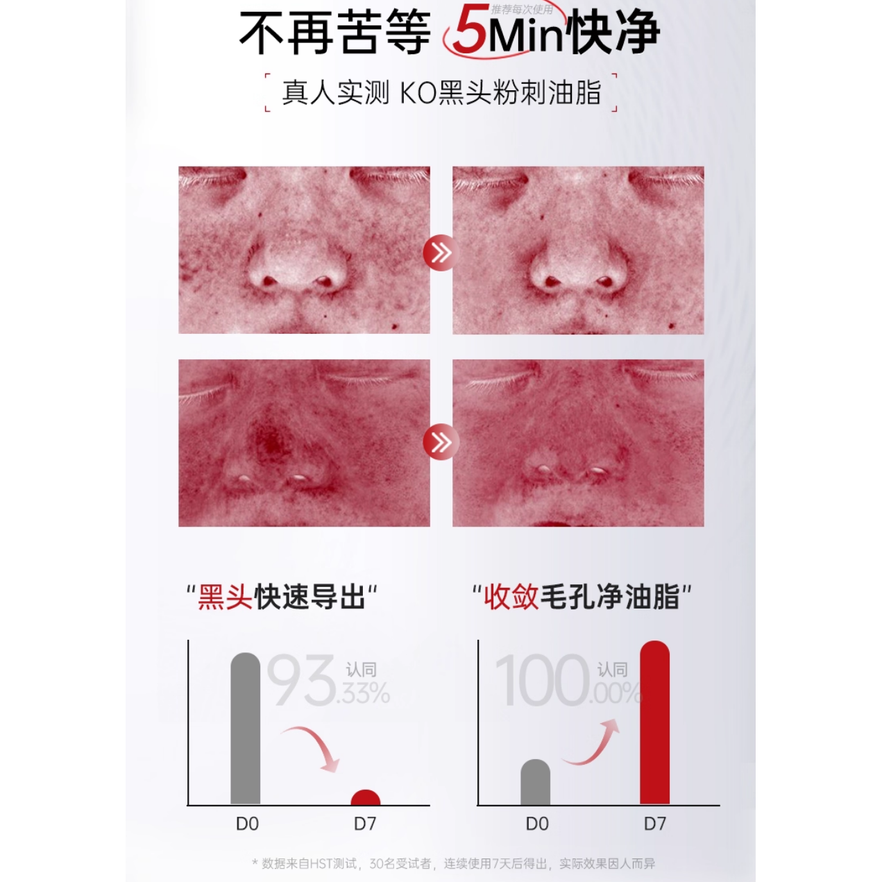 Bai Yun Shan Azelaic Mud Mask Stick 40G X 2 Sticks – Clear Pores Radiant Skin