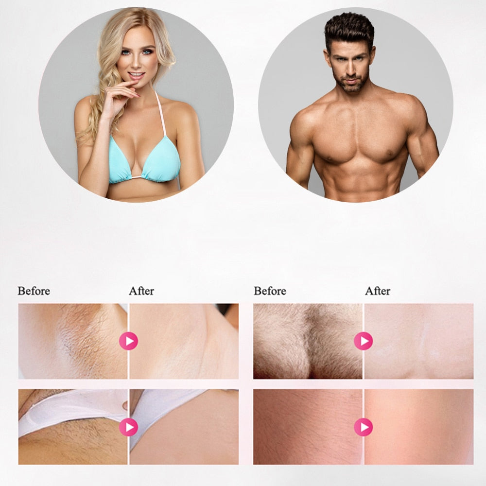LippyTime IPL Laser Hair Removal Device – Full Body, 600,000 Flashes