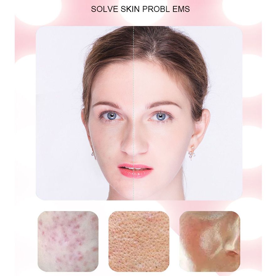 High-Quality LED Ice Light Skin Rejuvenation Device – Pore Cleaner & Face Wash Tool