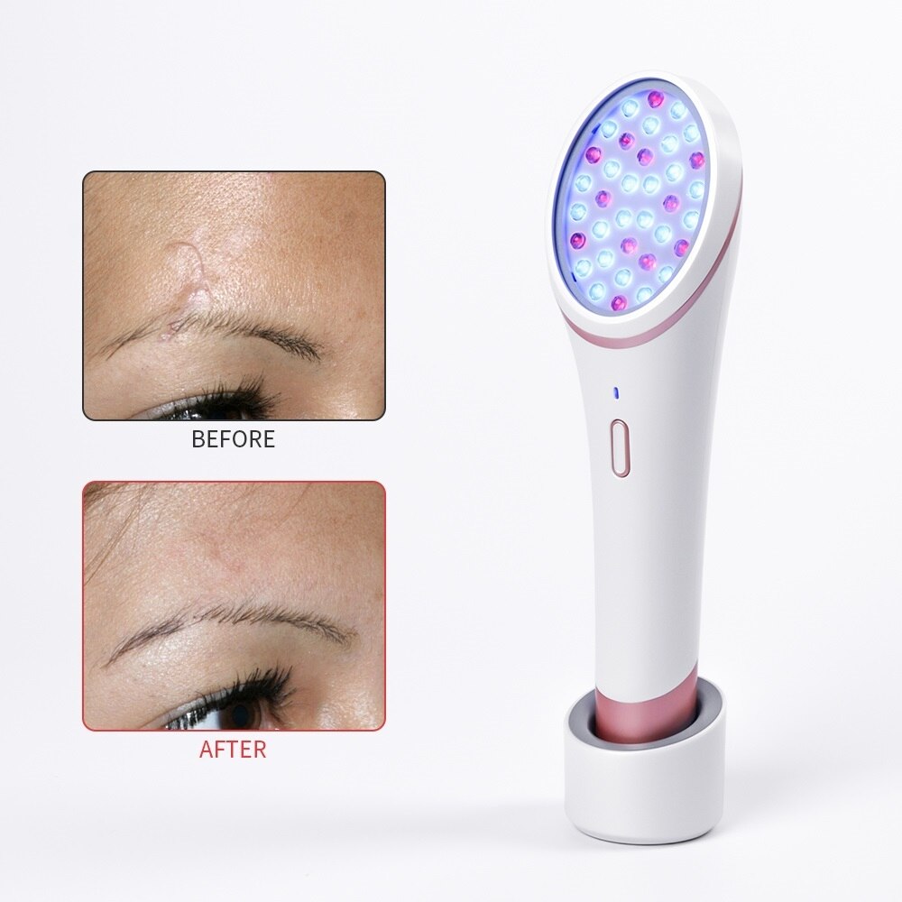 LED Photon Skin Rejuvenation Light Therapy Device – Red & Blue Light Acne Treatment, Wrinkle Reduction & Skin Repair Tool