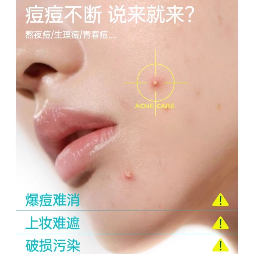 EIIO Acne Care Clear Patch 46 Patches - Calms Breakouts