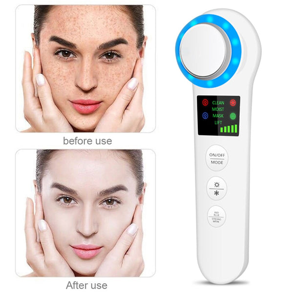 Ultrasonic Hot & Cold Facial Lifting Massager – EMS Ion Skin Rejuvenation Device