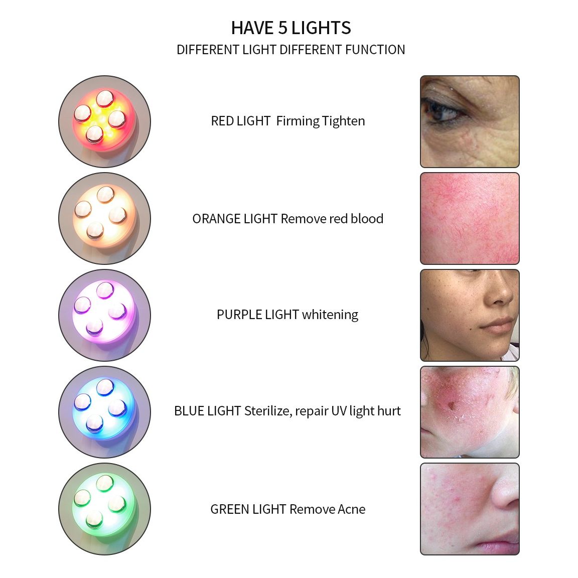 5-in-1 LED Light Therapy Facial Device – USB Rechargeable Skin Rejuvenation & Firming Beauty Tool for Wrinkles, Acne & Pigmentation