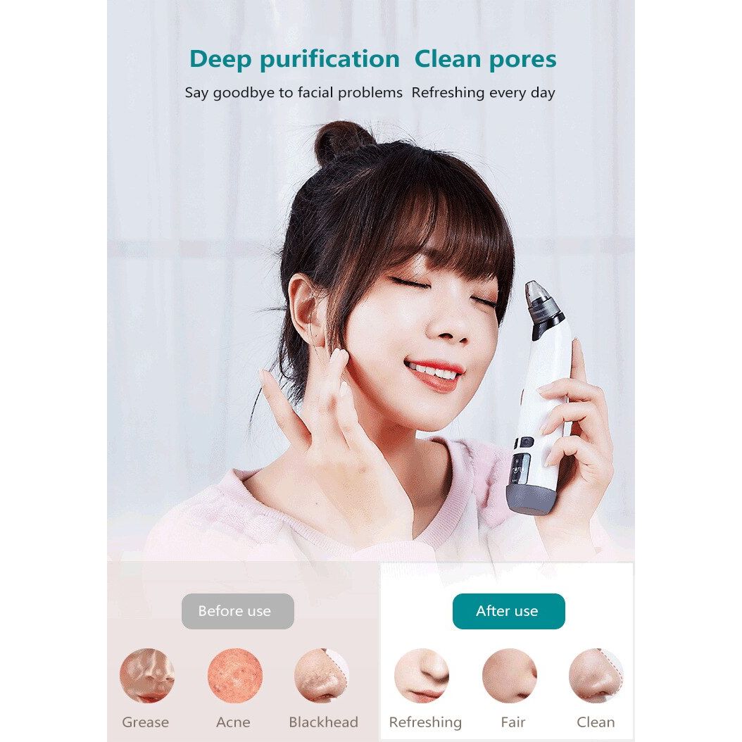 Upgraded Vacuum Blackhead Remover 3 Levels – Deep Pore Care