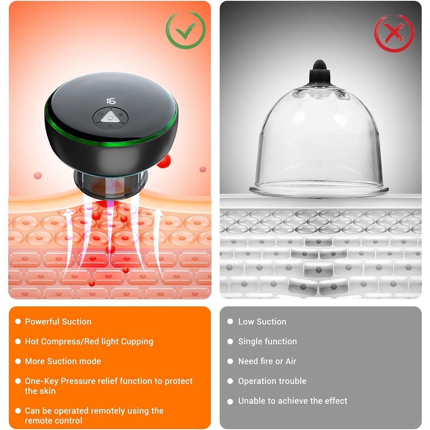 Electric Smart Cupping Therapy Set – 5-in-1 Remote Control Cupping Device with Red Light Therapy for Pain Relief & Muscle Recovery