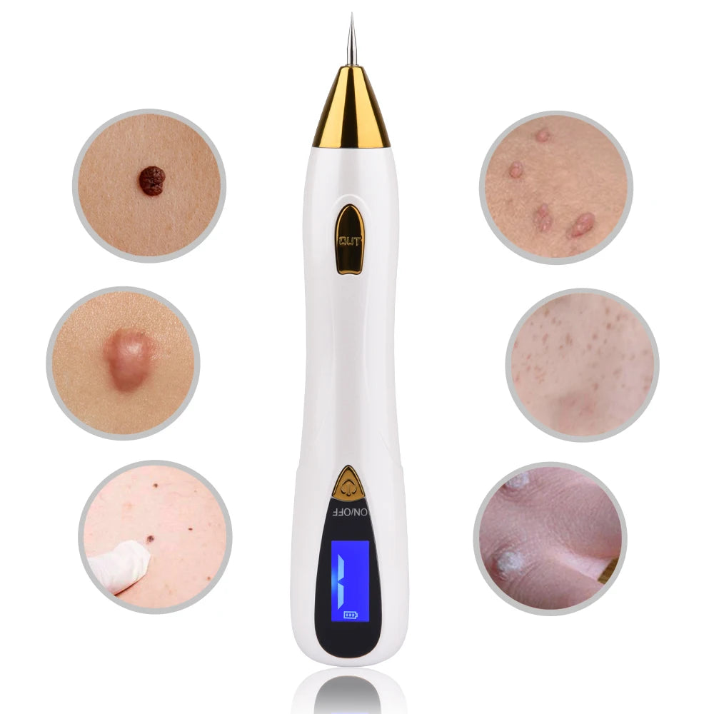 Skin Care Laser Mole & Freckle Removal Pen – LCD Display Spot Remover for Warts, Dark Spots & Tattoo Fading