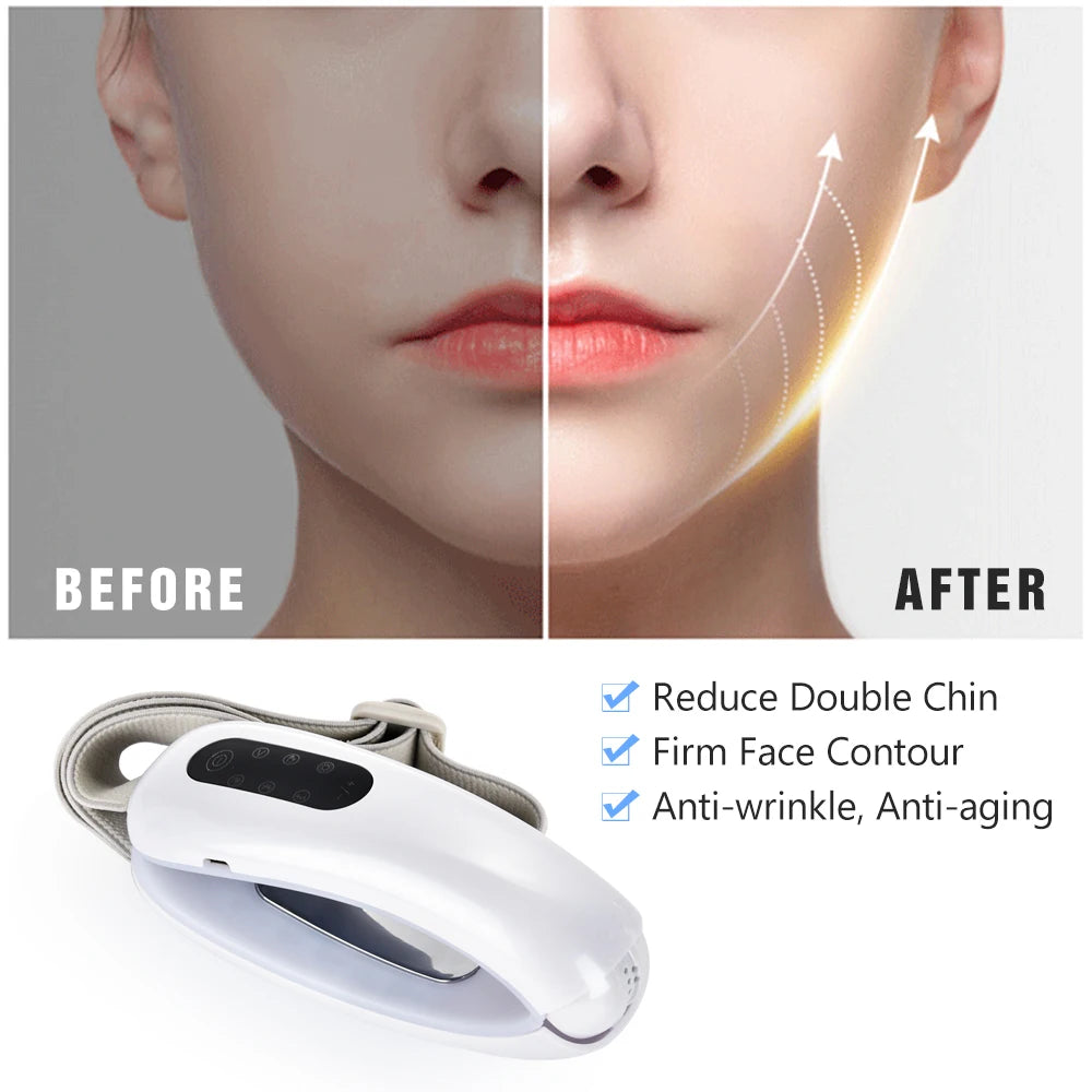 Chin V-Line Up Lift Belt – Red & Blue LED Photon Therapy Face Slimming Device