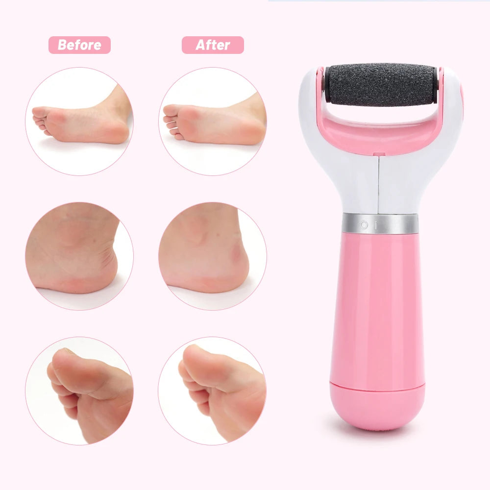 Portable Electric Foot & Heel Care Tool – USB Rechargeable Pedicure Set for Smooth Feet, Heels & Toes