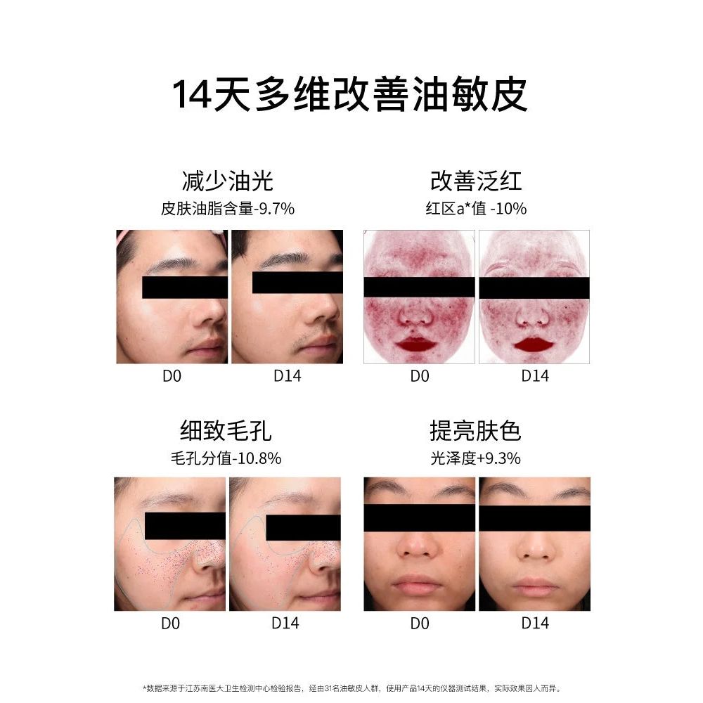 John Jeff Turmeric Lotion 120g – Oil Control & Soothing Emulsion