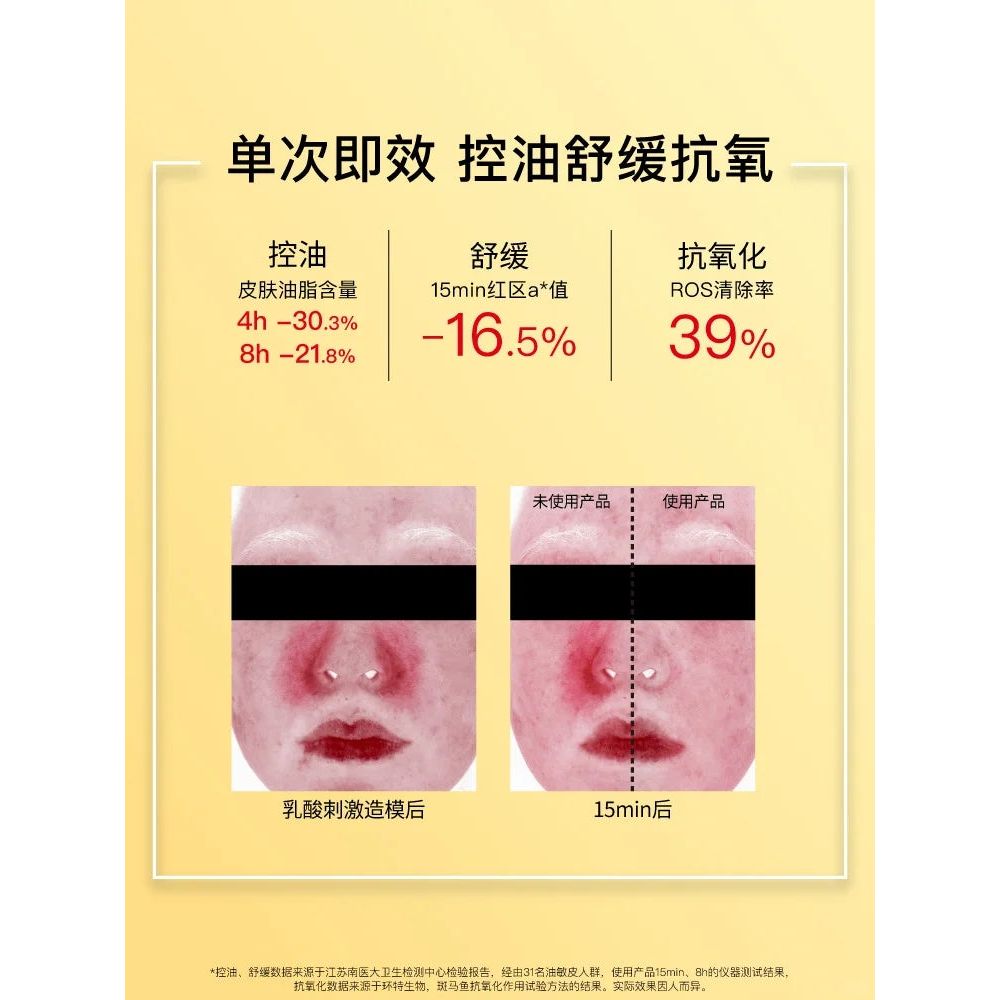 John Jeff Turmeric Lotion 120g – Oil Control & Soothing Emulsion