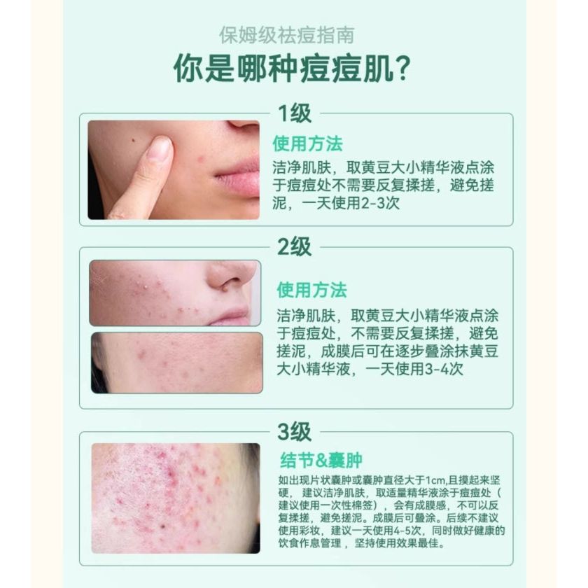 Yin Shi Gentle Acne Treatment Serum 15ml – Calming Clarification Sensitive Skin