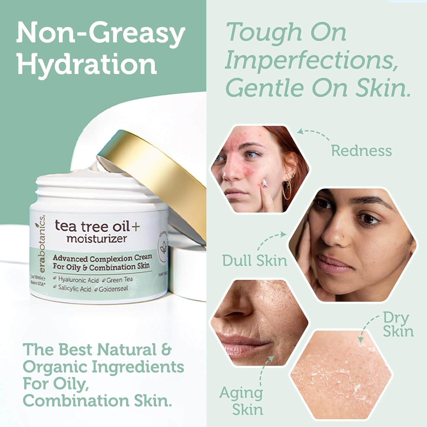 Era Organics Tea Tree Oil + Moisturizer – 60ml | Blemish Control & Oil Balancing Cream