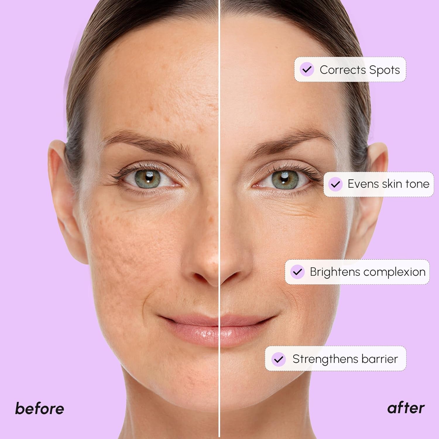 MAREE 20% Tranexamic Face Serum Spot Corrector – 30ml