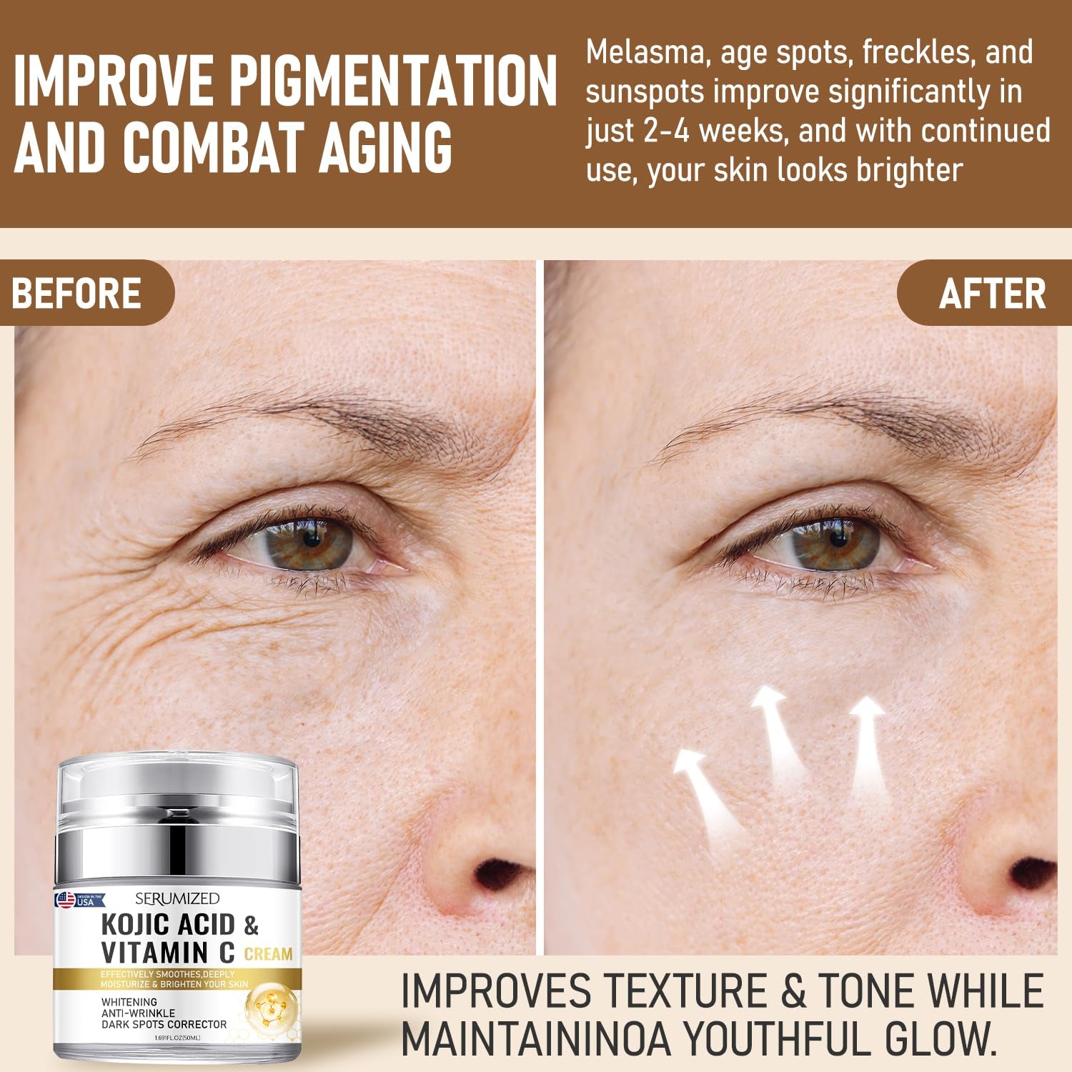 Serumized Kojic Acid & Vitamin C Brightening Cream – 50ml | Fade Dark Spots, Smooth Skin Texture & Boost Radiance
