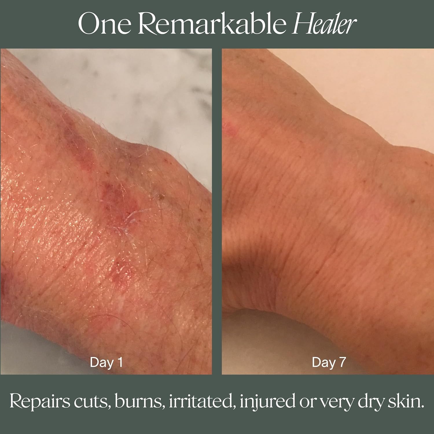 Doctor Rogers Restore Healing Balm – 114g | Multi-Purpose Repair & Hydration