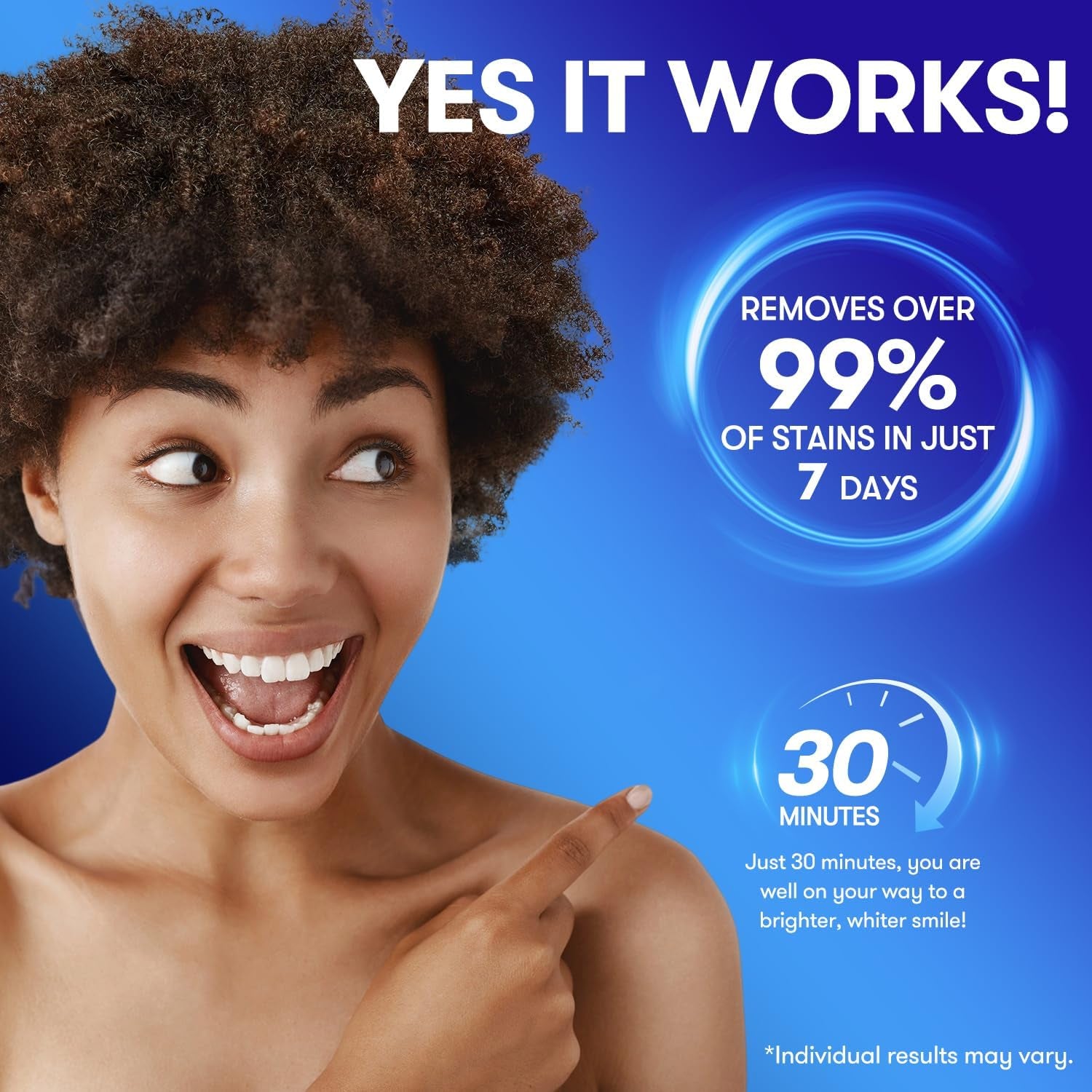 MySmile No-Slip Teeth Whitening Strips – 21 Treatments (42 Strips) | Professional Whitening, Stain Removal & Long-Lasting Freshness