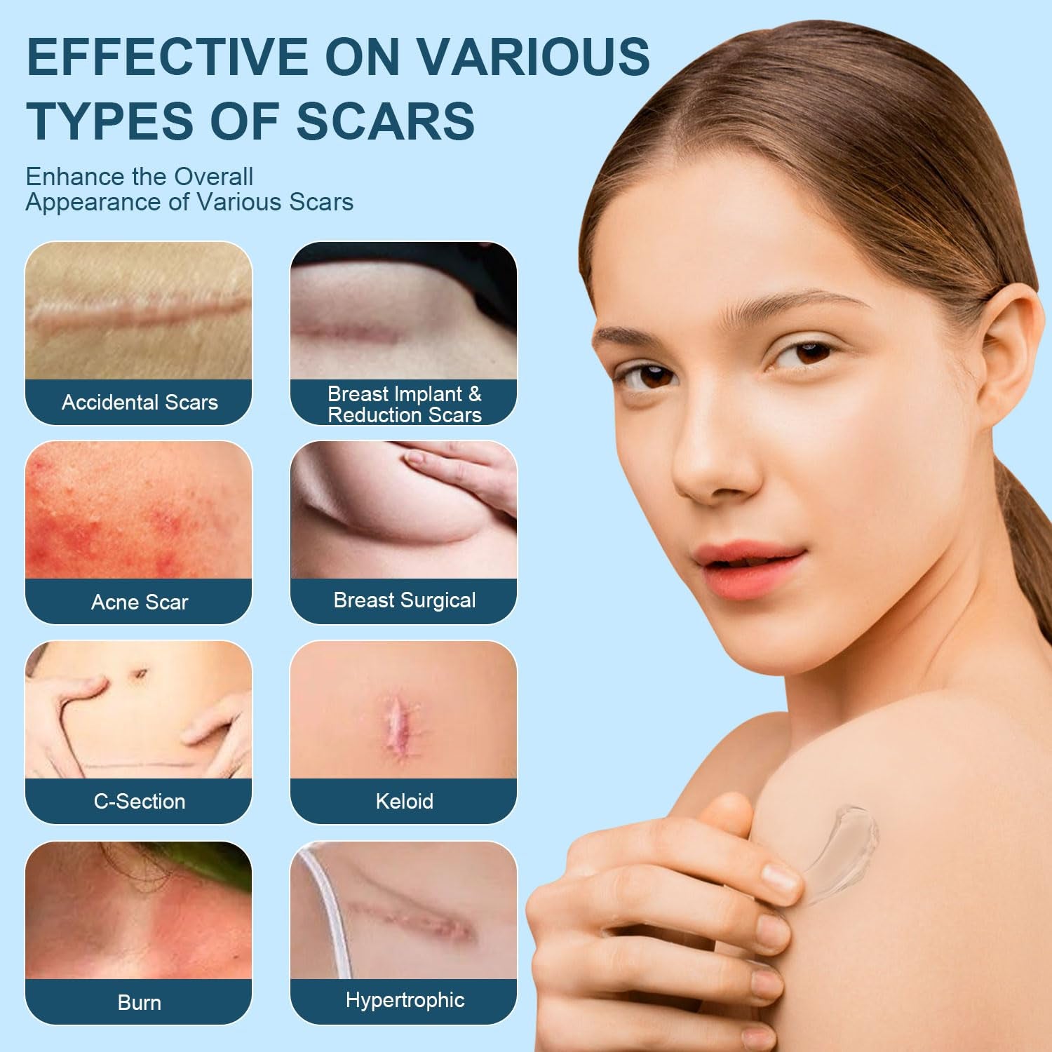 Mitgary Advanced Silicone Scar Gel - 50ml