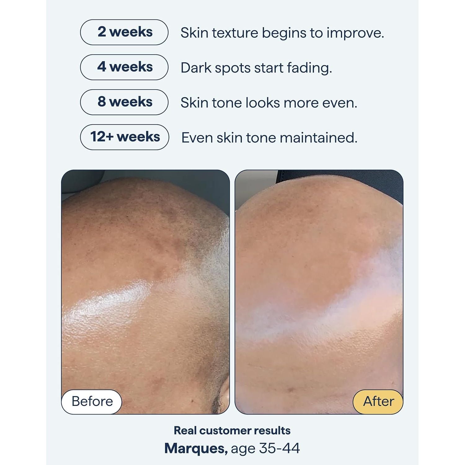 Remedy for Dark Spots Nightly All-In-One Treatment - 30ml