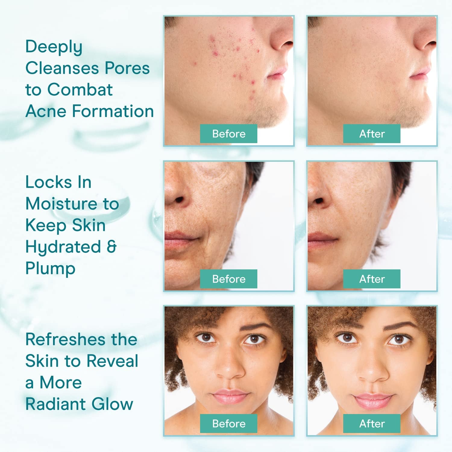 Baebody Collagen Micellar Face Cleanser – 236ml | Hydrating Makeup Remover & Skin-Firming Wash
