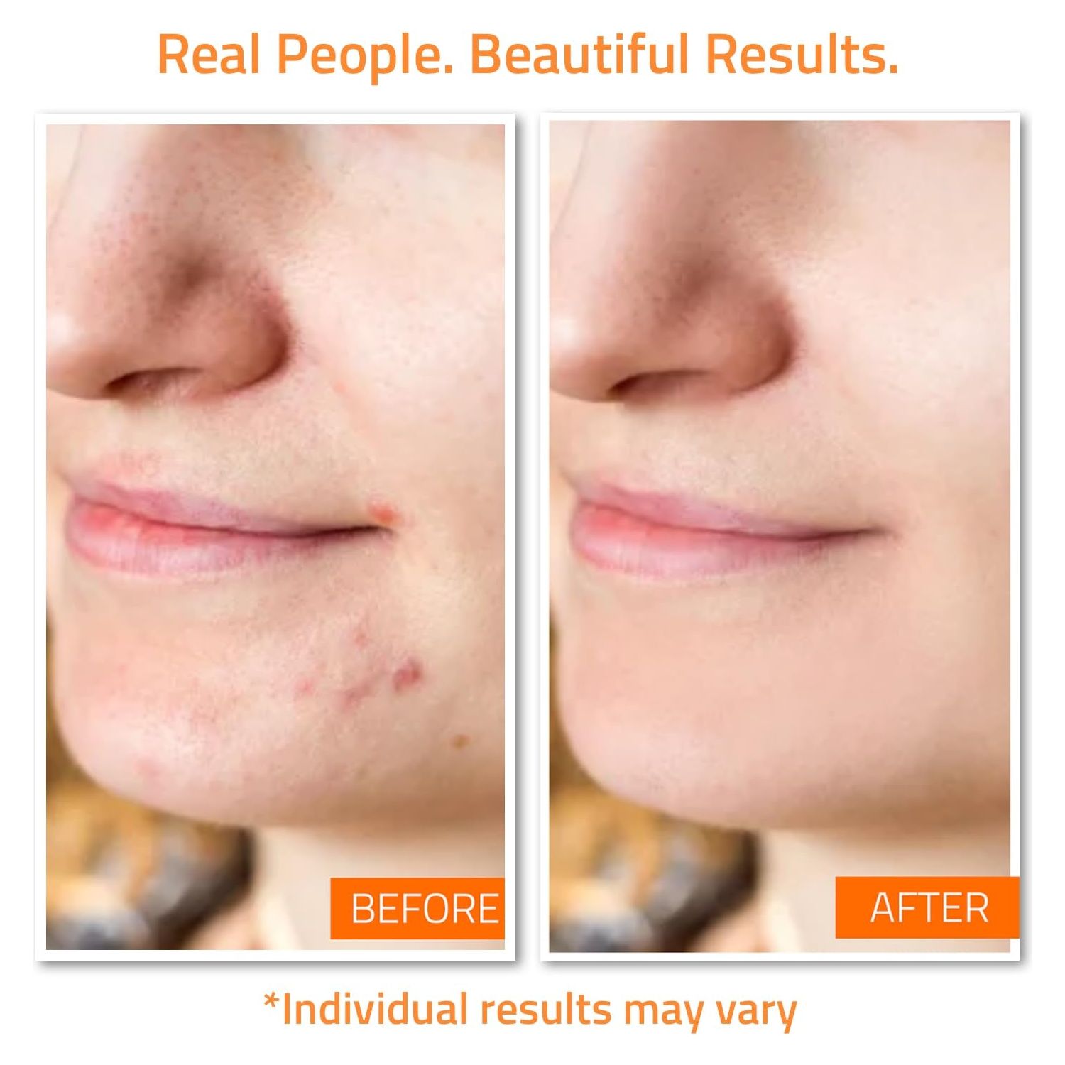 YEOUTH Blemish-Fighting Skin Care Set | Complete 7-Step Routine with Vitamin C, Retinol, Salicylic Acid & Hyaluronic Acid | Dermatology-Tested, USA-Made