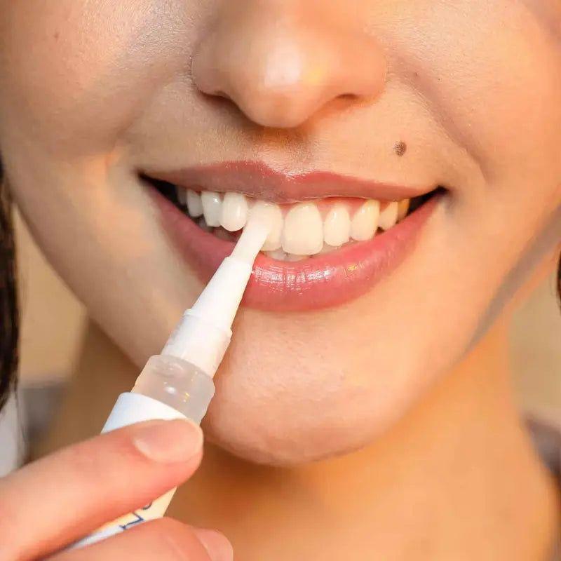 SNOW Diamond Wireless Teeth Whitening Kit