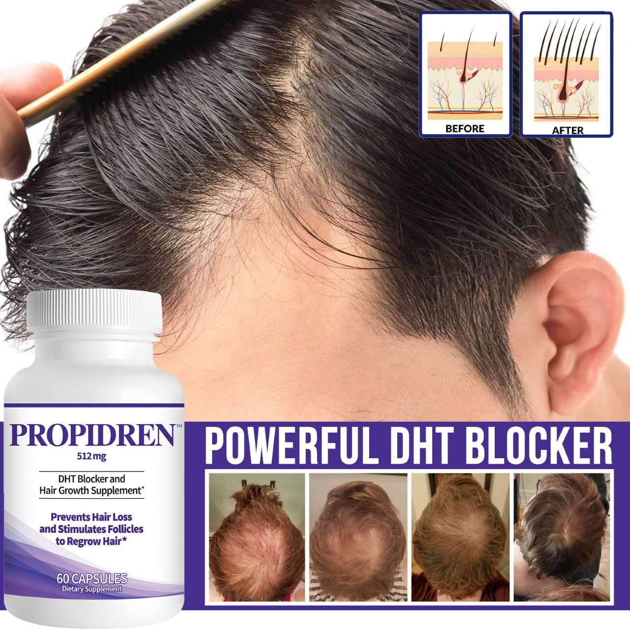 Pronexa Propidren – 512mg - 60 Capsules | DHT Blocker with Saw Palmetto, Biotin & Herbal Complex for Hair Loss Prevention