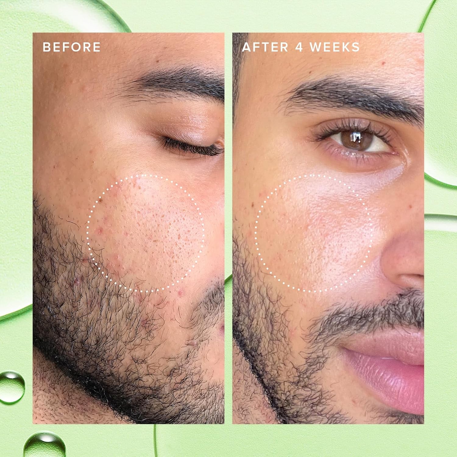 2% Salicylic Acid Toner for Face - Deep Sweep BHA Liquid Exfoliant + Pore Cleaner - Controls Oil, Gently Exfoliates + Refines Pores - Skin Care for Combo, Oily + Blemish-Prone Skin - (120Ml)