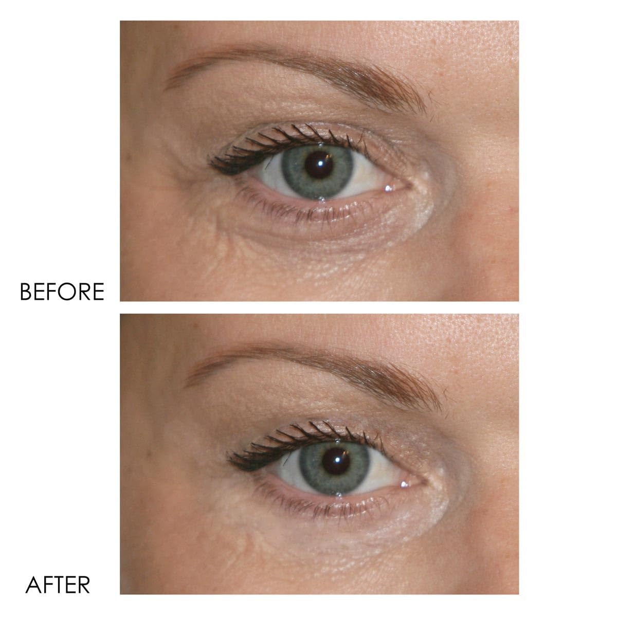 Dermelect Cosmeceuticals Revitalite Eyelid & Dark Circle Corrector – 15ml | Brightening & Firming Eye Cream