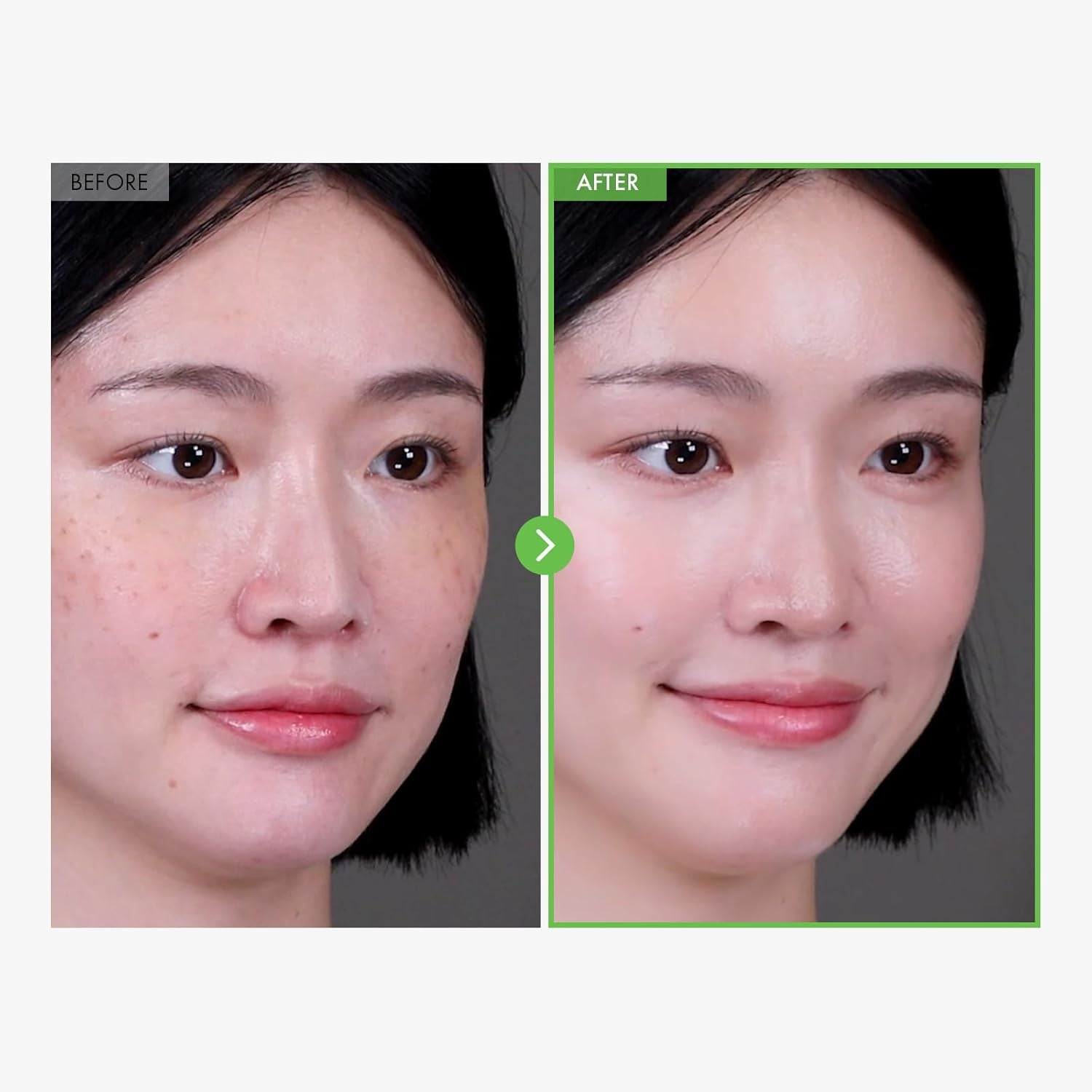 Kakadu Plum Blemish Cream, Dark Spot Remover for Face Cream, Kakadu Plum 600,000Ppm, Niacinamide, Adenosine, Betaine, Dark Spot Corrector, Vitamin C, Korean Skin Care, 50G, 1.76 Oz.