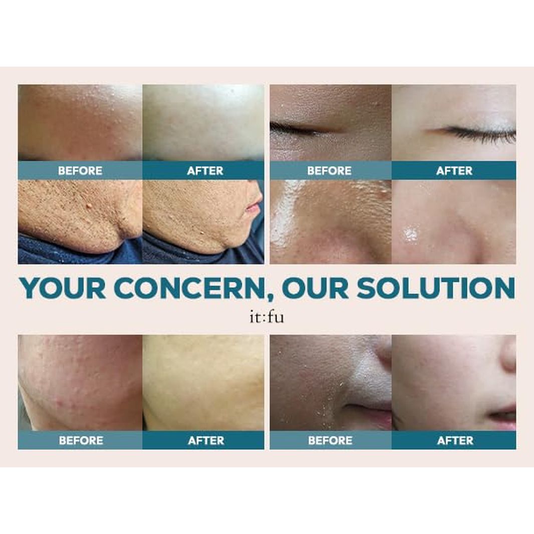 it:fu Repair Therapy Soonyuul Cream - 50ml