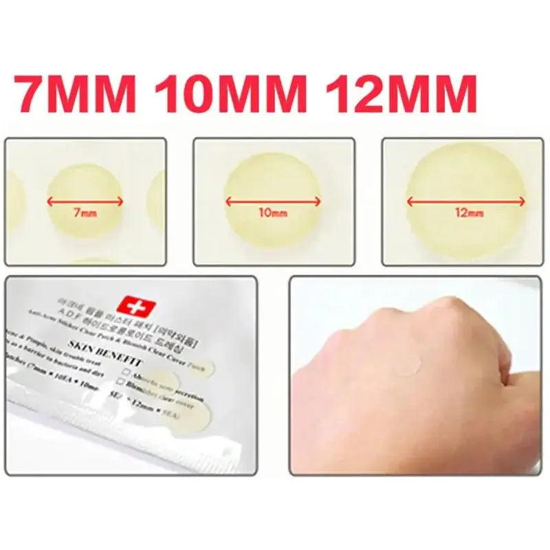 Acne Pimple Invisible Patch – Discreet Acne Treatment for Clear Skin - Glam Global UK