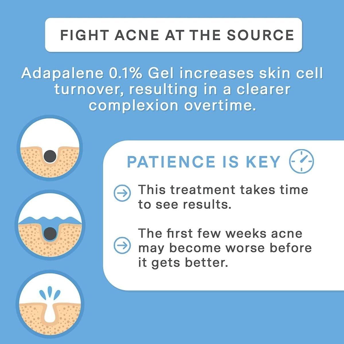 Adapalene 0.1% Acne Free Gel (45Gr 1.6Oz 90 Day Supply - XL Tube) - Topical Retinoid Acne Medicine - Stop Acne Whiteheads Blackheads & Clogged Pores - Adapalene Retinoid Acne Treatment for Face - Glam Global UK