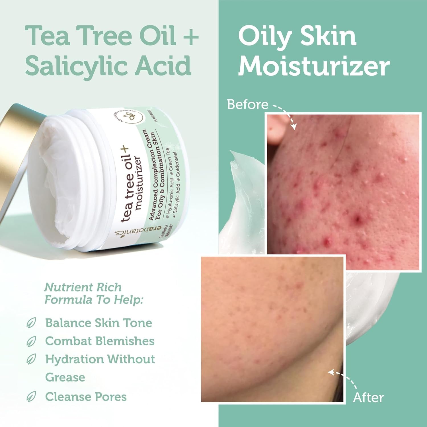 Era Organics Tea Tree Oil + Moisturizer – 60ml | Blemish Control & Oil Balancing Cream