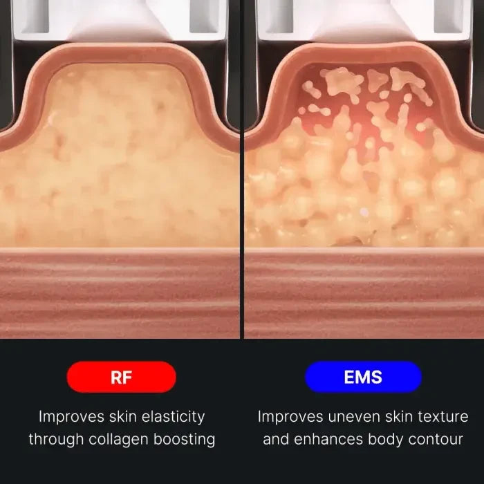 AGE - R Contour Body Shot - Glam Global UK