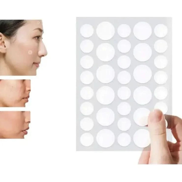 Anti - Acne Concealer Patch – Instant Acne Removal & Concealing Solution (72 Pcs) - Glam Global UKGlam Global UK