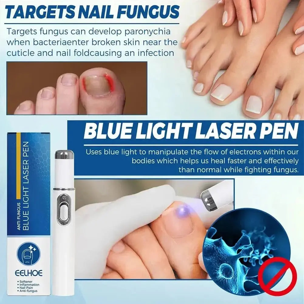 Antifungal Laser Device - Glam Global UK