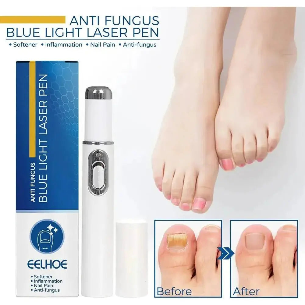 Antifungal Laser Device - Glam Global UK