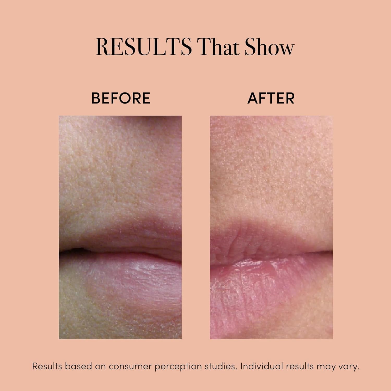 reVive Light Therapy Lip Plumper Device | FDA-Cleared Red Light Lip Care Tool
